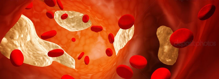 hogyan lehet eltávolítani a vörös foltokat a streptoderma-ból