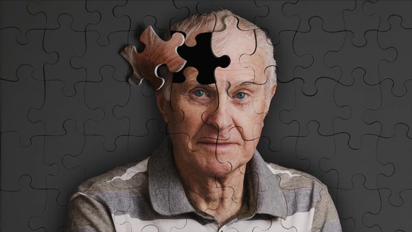 Alzheimer's -disease-1-62