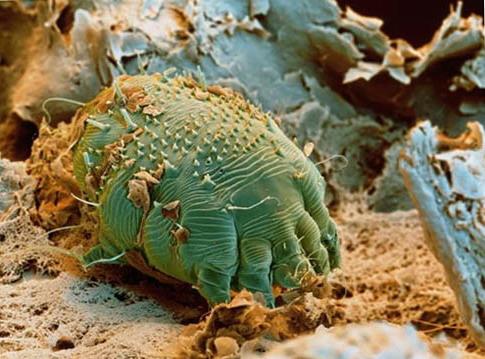 How- to- recognize- scabies-555