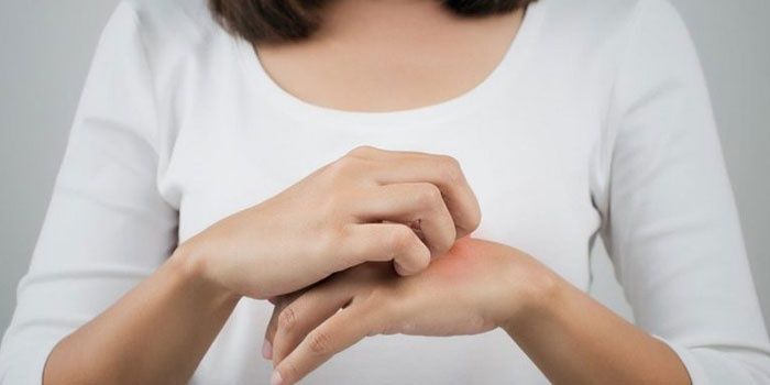 Woman scratches a mosquito bite on her hand