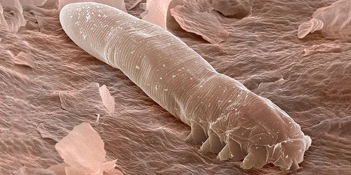 Demodex tick under the microscope